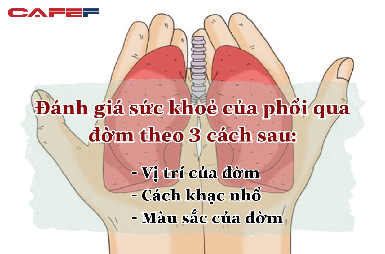 Cách xử lý khi phát hiện đờm bất thường