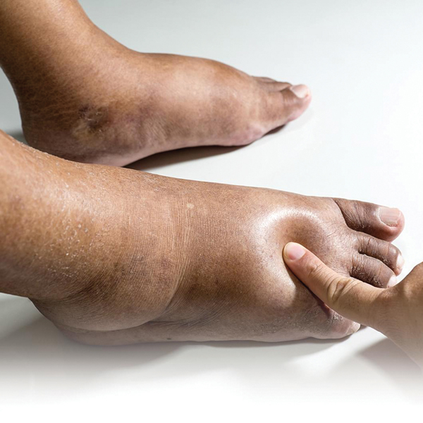 [TẾT] 6 vị trí đau chân này là “manh mối” của các loại bệnh khác nhau: Nhẹ thì đau nhức xương khớp do thời tiết, nặng có lẽ bệnh tiểu đường đang đến rất gần, nhất định không được xem nhẹ - Ảnh 2.