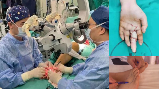 Cô gái 19 tuổi bị rách bàn tay và lột da ngón giữa, phải phẫu thuật suốt 13 tiếng chỉ vì sai lầm khi tháo nhẫn nhiều người mắc phải - Ảnh 2.