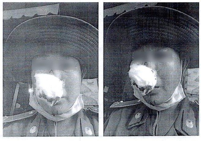 UBND TP.HCM yêu cầu xử lý nghiêm vụ nữ nhân viên thu phí bị hành hung - Ảnh 1. UBND TP.HCM yêu cầu xử lý nghiêm vụ nữ nhân viên thu phí bị hành hung - Ảnh 1.