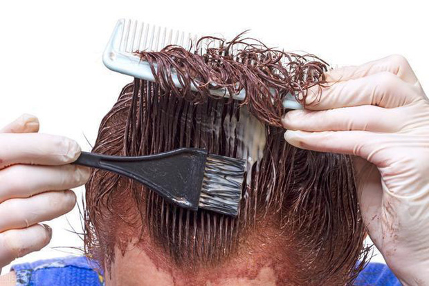 Nhuộm tóc liên tục trong 16 năm, chàng trai 36 tuổi hối hận khi phát hiện ung thư da! Nhuộm tóc có thực sự gây ung thư? - Ảnh 3.