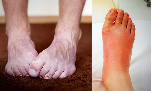  4 biểu hiện ở bàn chân cho thấy bạn cần đến gặp bác sĩ càng sớm càng tốt - Ảnh 2.