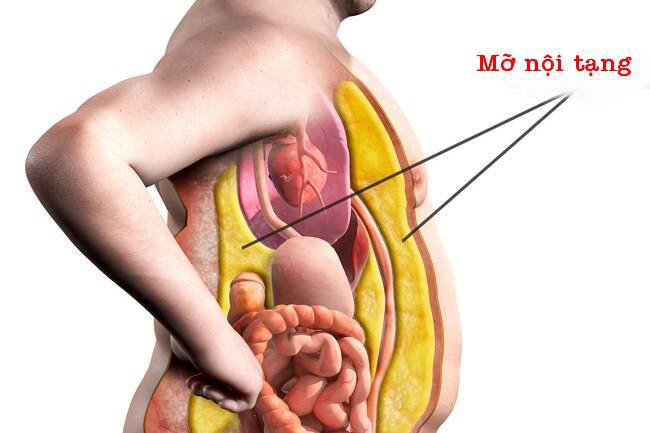 7. Những Điều Cần Lưu Ý Khi Giảm Mỡ Nội Tạng