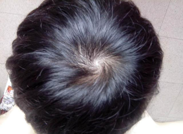 nếu bạn bấm vào các huyệt này hàng ngày thì tóc sẽ ngày càng khỏe mạnh Photo-1-1644112936603520435471