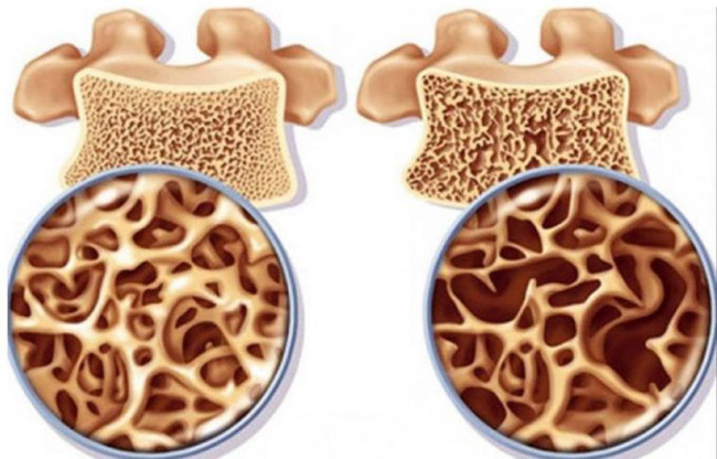 Sau tuổi 30, phụ nữ cần thường xuyên ăn 8 món để tránh mất xương dần dần, khuyến cáo 2 việc cần tránh, một việc phải làm để xương khỏe, người dẻo dai - Ảnh 3.