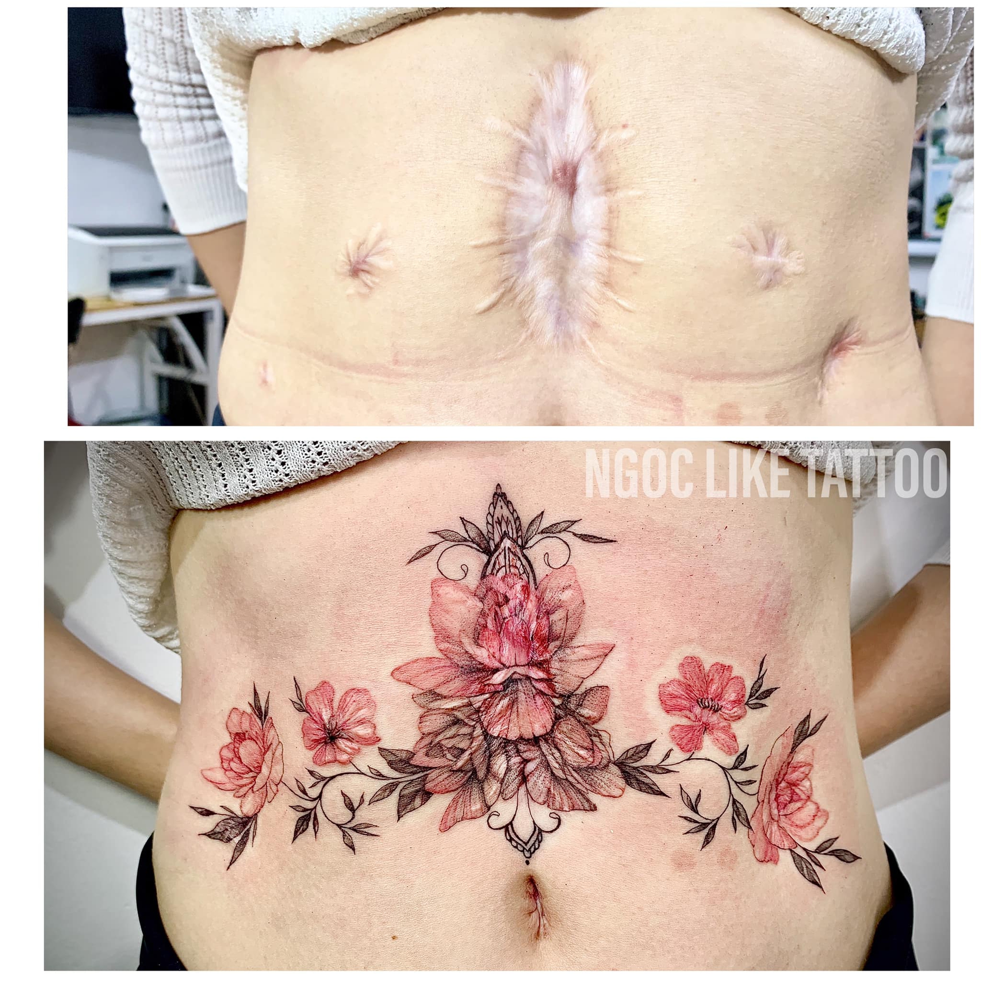 Che sẹo mổ hút mỡ bụng  Tattoo Gà Xăm Nghệ Thuật Gò Vấp  Facebook