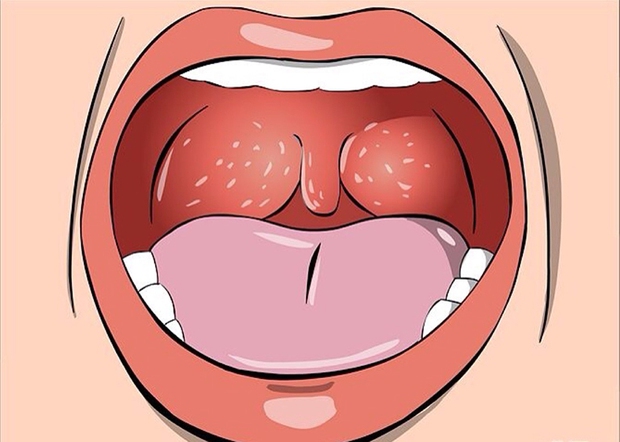 3 triệu chứng xuất hiện ở cổ họng ngầm cảnh báo phổi đang bị tổn thương, ngay từ điều đầu tiên đã rất đáng lo - Ảnh 1.