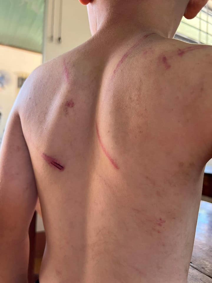 Cháu bé 9 tuổi bị bà và cha đánh đập dã man - Ảnh 1. Cháu bé 9 tuổi bị bà và cha đánh đập dã man - Ảnh 1.