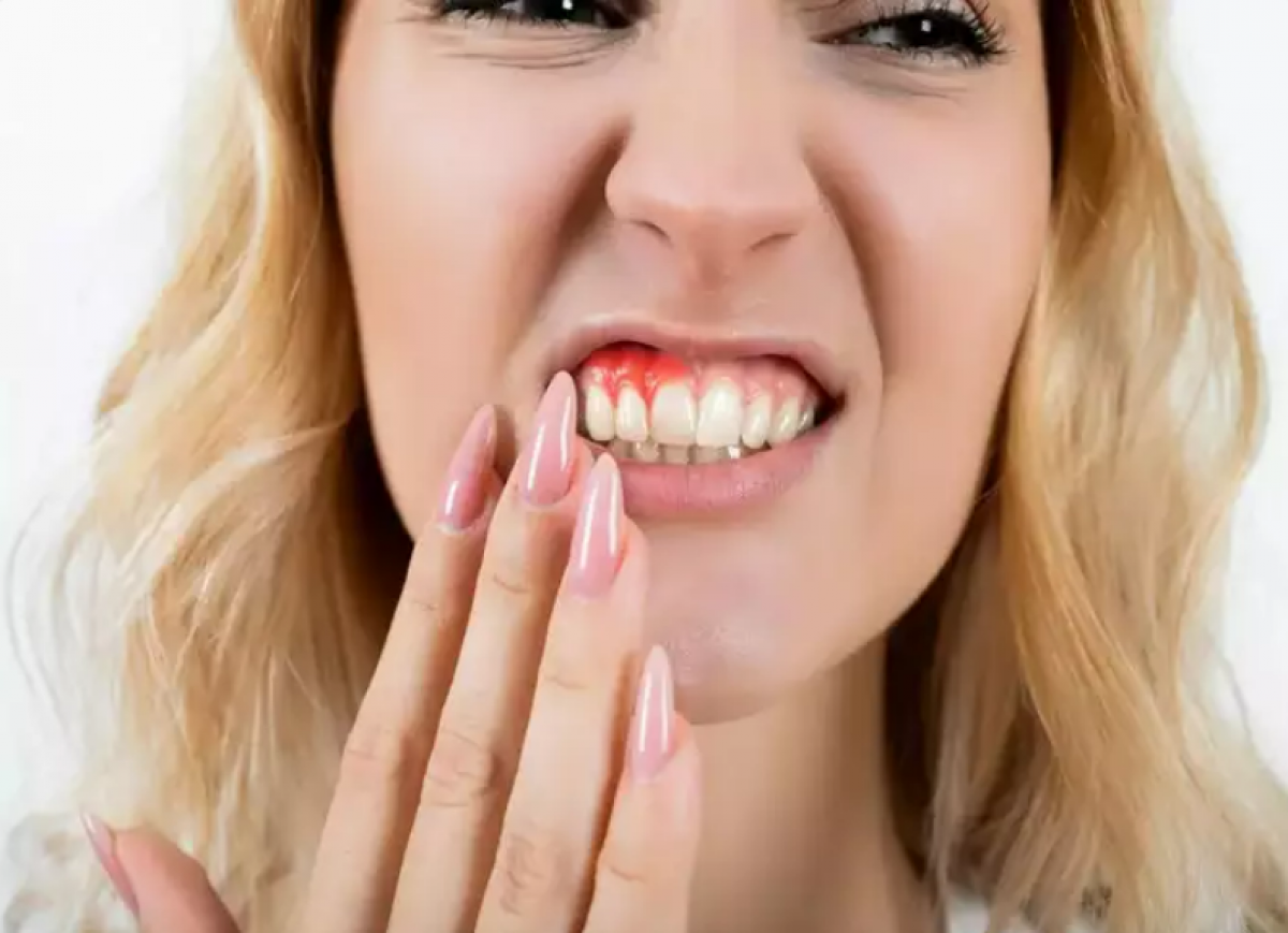 Vitamin A là gì? Vitamin A là gì?