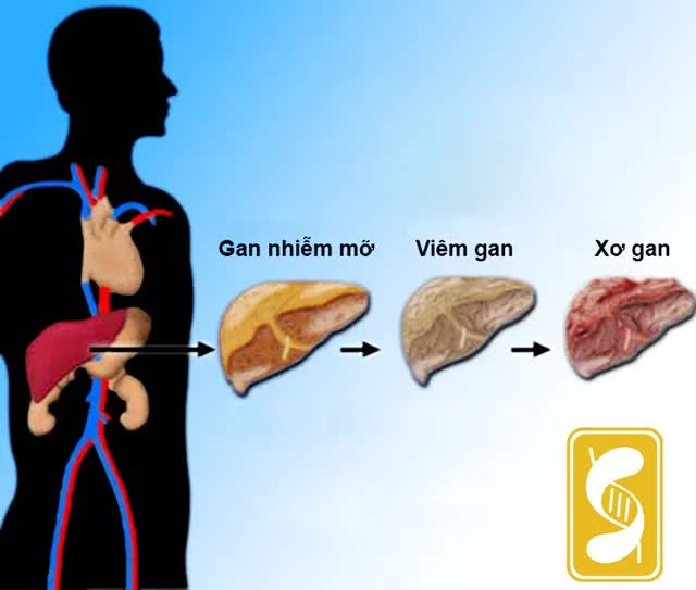 Mùa hè, gan thích nhất những thực phẩm này, nên bổ sung ngay để kéo dài tuổi thọ - Ảnh 1.