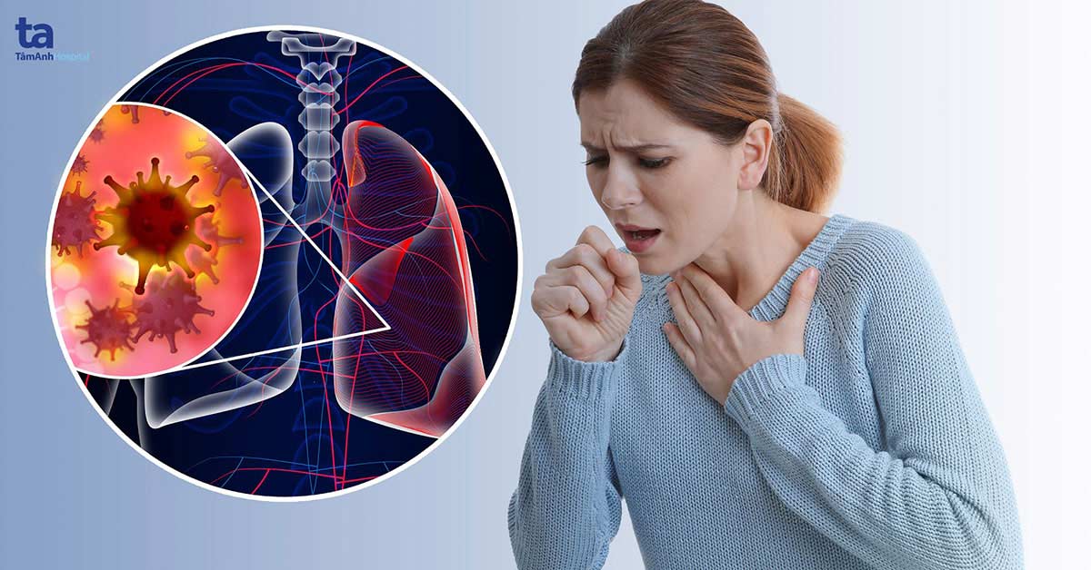 Người phụ nữ đau vai gáy, đi khám phát hiện ung thư phổi: Bác sỹ BV K chỉ ra 12 dấu hiệu quan trọng nhất - Ảnh 2.