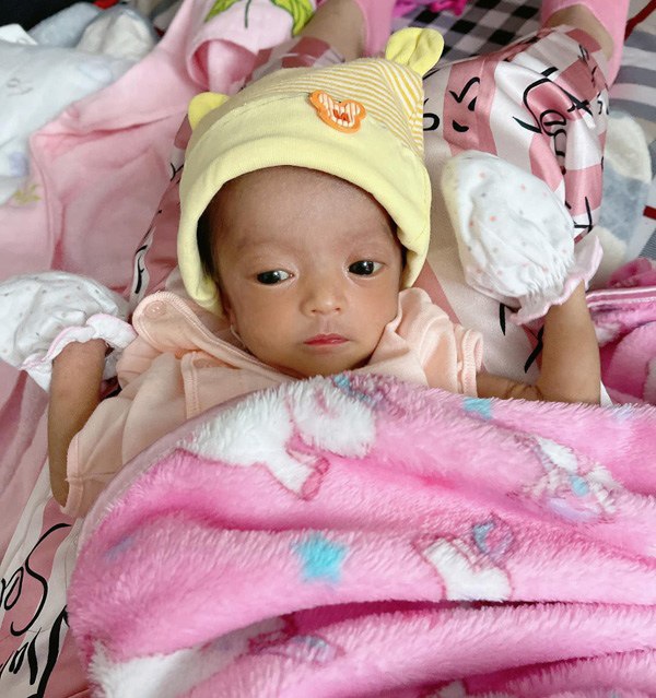 Leon - Lisa nhà Hà Hồ phải dùng ống thở, con Khánh Thi 1,9kg tím tái vì sinh non: Lớn lên thay đổi ngoạn mục- Ảnh 7.