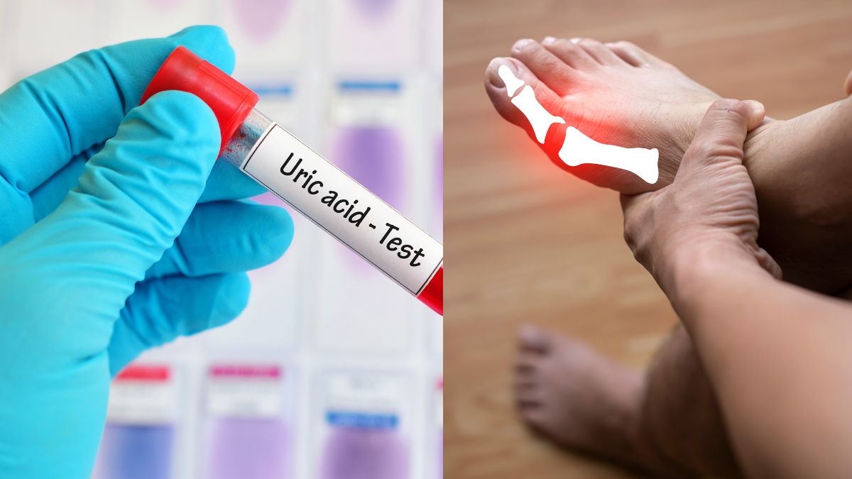 10 cách 'đào thải' acid uric một cách tự nhiên, ngừa gout hiệu quả: Nhiều người chưa biết để làm - Ảnh 1.