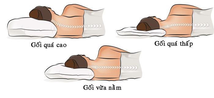 1 thói quen vô tình khiến tình trạng thiếu máu lên não trầm trọng thêm, người bệnh tim mạch lưu ý điều chỉnh ngay - Ảnh 3.