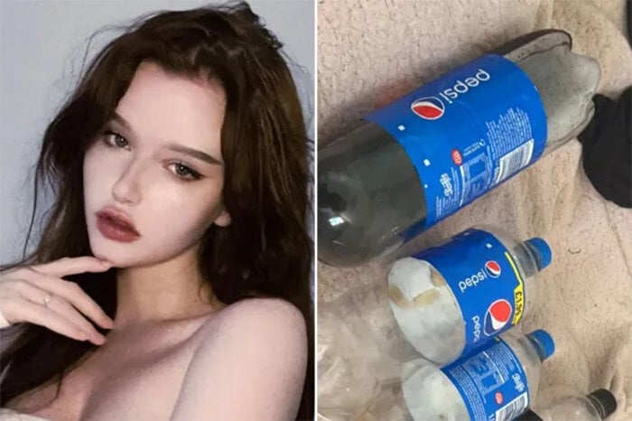 Cô gái nghiện Pepsi đến mức uống 4 lít/ngày, nếu không uống sẽ ốm nặng - Ảnh 1.