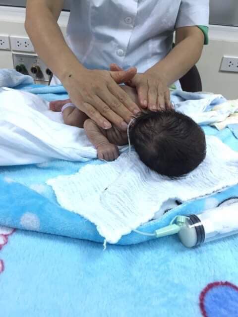 Hành trình kỳ diệu của bé sinh non 1kg, bác sĩ từng phán: "Đứa bé chết đi sống lại mấy lần, không thể tin được"- Ảnh 2.