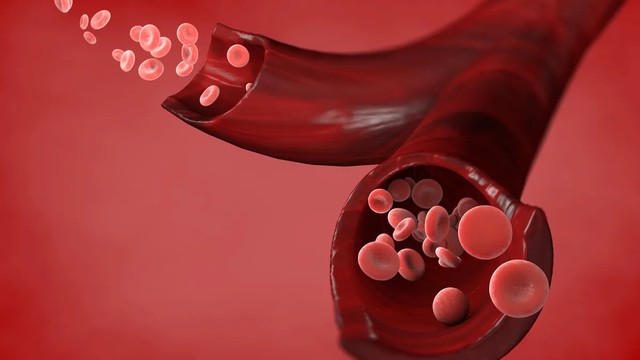 Người thuộc nhóm máu này ít khả năng bị bệnh tim nhất nhưng dễ mắc một tình trạng nguy hiểm - Ảnh 1.