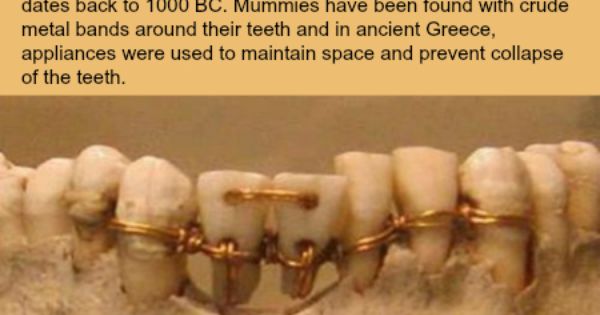 Những điều ít biết về phương pháp niềng răng từ thế giới cổ đại - Ảnh 1.