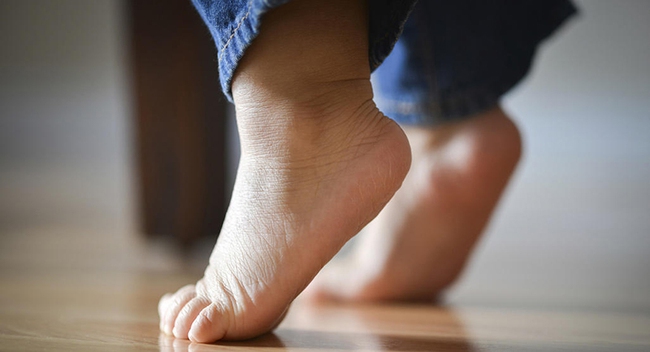Một dấu hiệu ở bàn chân của con cảnh báo mắc phải dị tật mà 25% trẻ mắc phải - Ảnh 3.