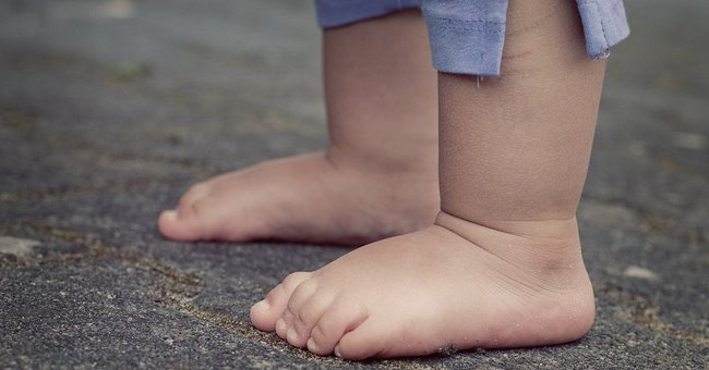 Một dấu hiệu ở bàn chân của con cảnh báo mắc phải dị tật mà 25% trẻ mắc phải - Ảnh 2.