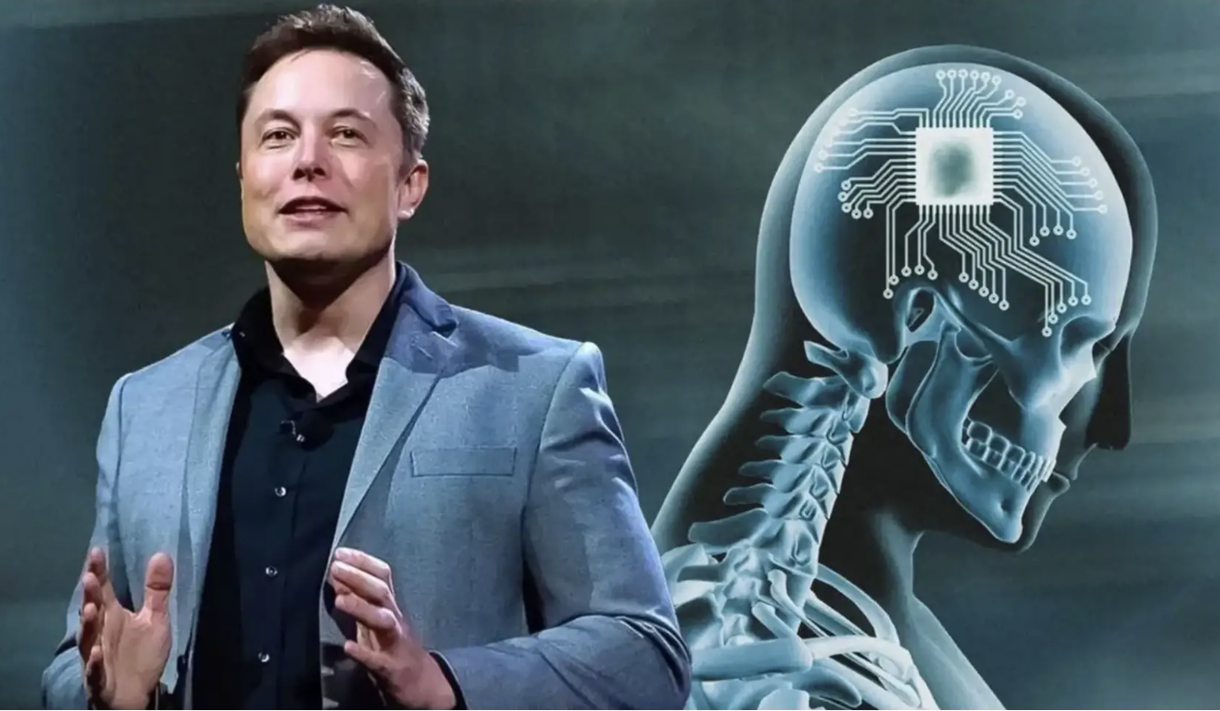 Công ty của Elon Musk được phép thử nghiệm cấy chip vào não người - Ảnh 1.