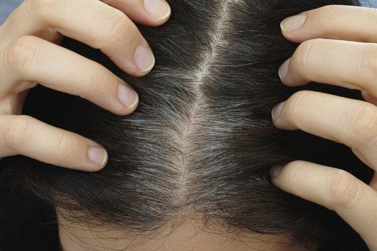 Thuốc nhuộm tóc có gây ung thư không? Nghiên cứu ĐH Harvard trong 35 năm đưa ra kết quả bất ngờ - Ảnh 2.