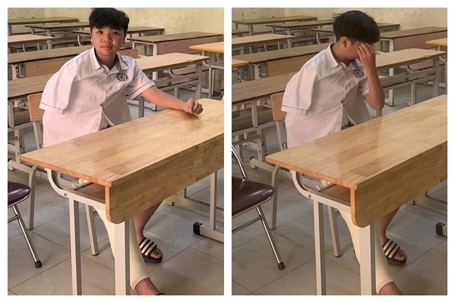 Hà Nội: Nam sinh gãy chân tay được bạn chép hộ bài thi lớp 10 - Ảnh 1.