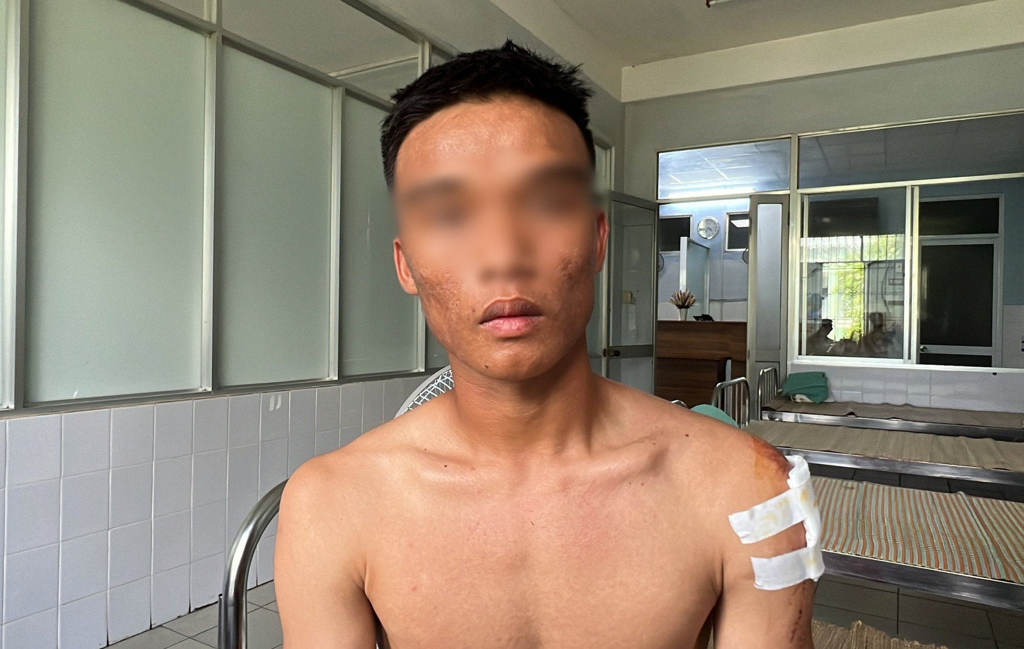 Cầu thủ Quảng Nam hoảng hồn kể lúc xe chở đội bóng mất lái, bị lật trên đèo khiến 4 người thương vong - Ảnh 3.