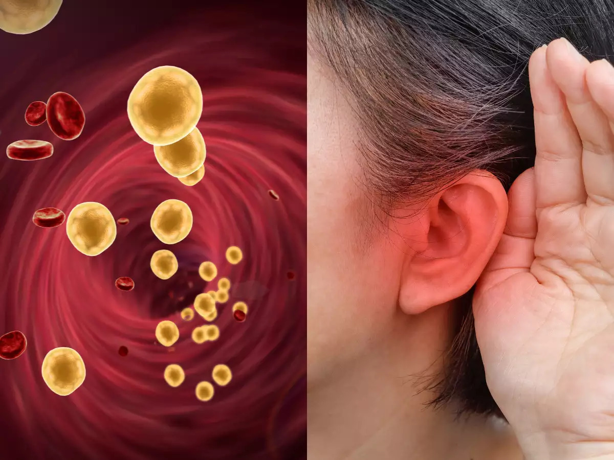 Khi mỡ máu tăng cao, tai sẽ phát ra 3 “tín hiệu” cảnh báo đỏ - Ảnh 1.