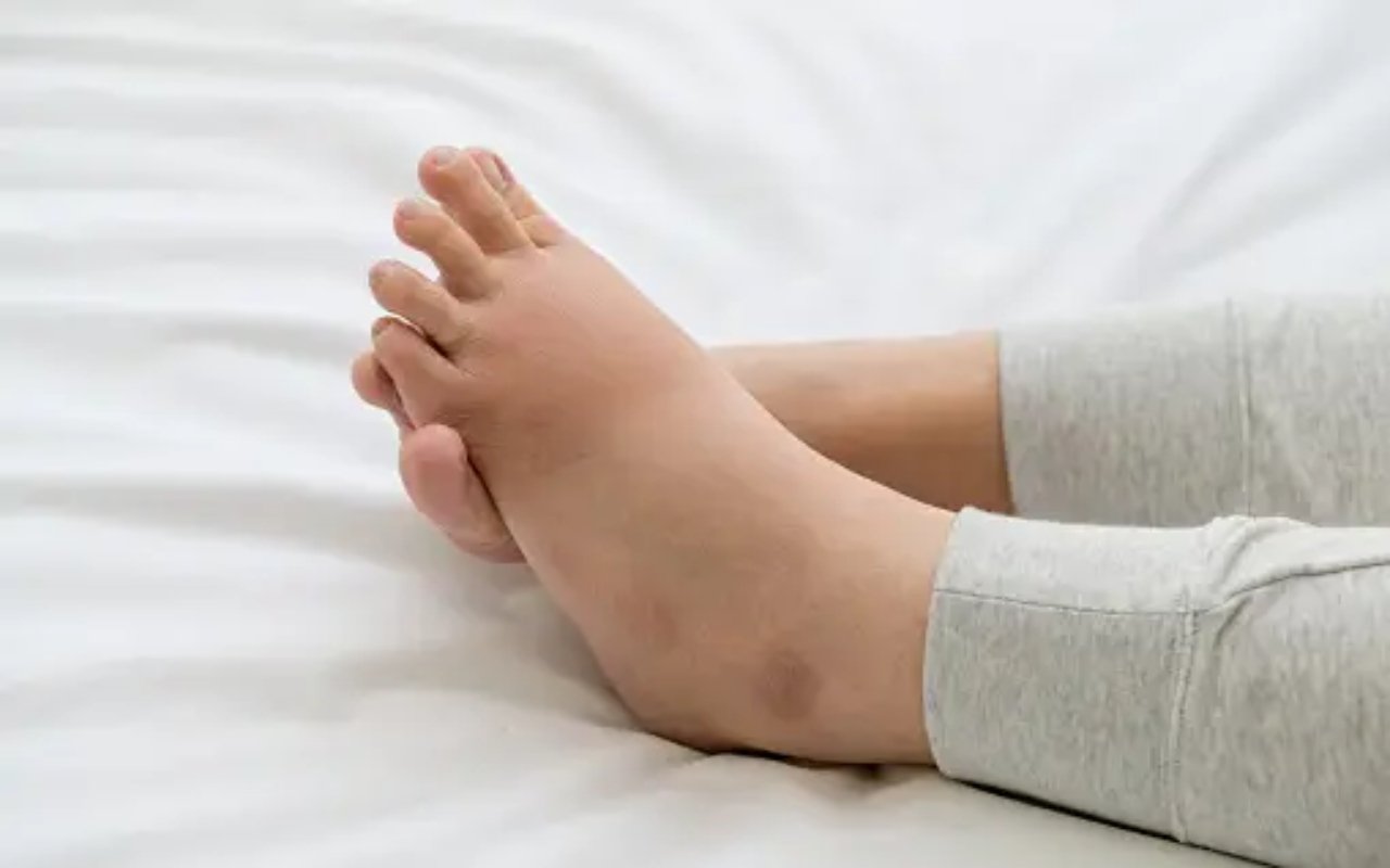 Khi gan suy hỏng, chân sẽ phát ra 5 dấu hiệu cảnh báo, có 1 cũng nên đi khám ngay- Ảnh 2.