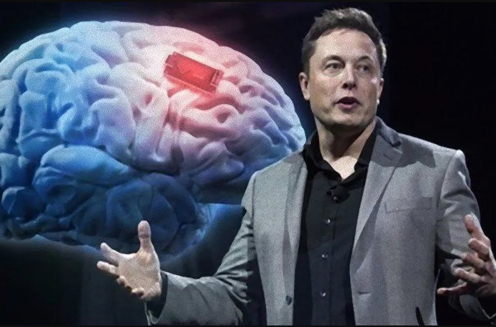 Gã ngông cuồng Elon Musk vừa làm được điều điên rồ: Lần đầu tiên cấy ghép thành công chip vào não người - Ảnh 1.