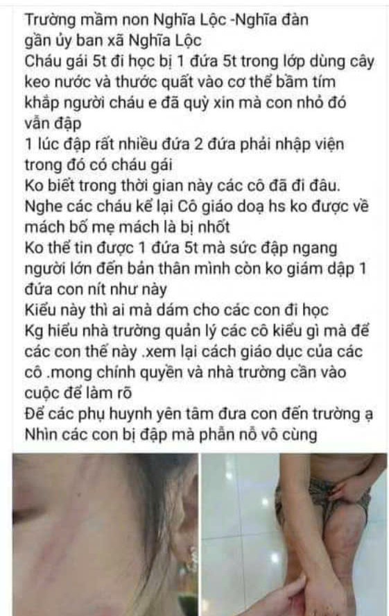 Nhiều trẻ mầm non bị bạn đánh bầm tím cơ thể tại lớp học- Ảnh 1.