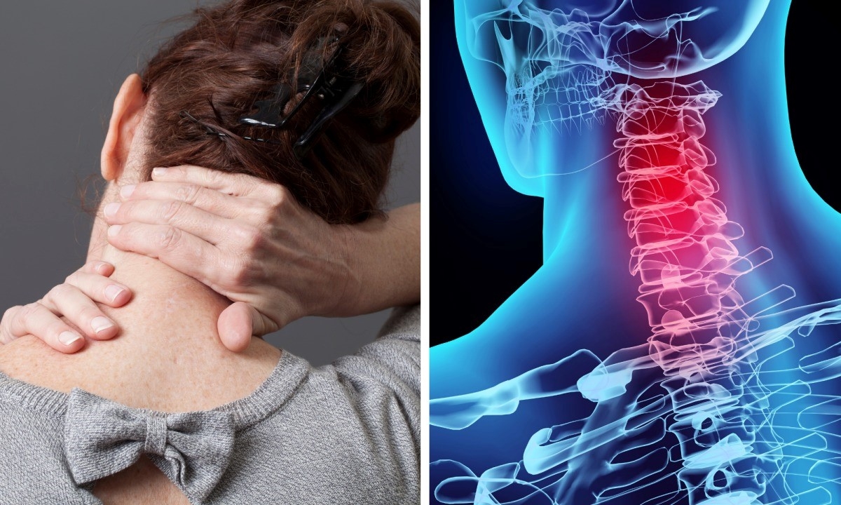 Hậu quả khôn lường từ thói quên bẻ, lắc cổ nhưng không phải ai cũng biết- Ảnh 1. Hậu quả khôn lường từ thói quên bẻ, lắc cổ nhưng không phải ai cũng biết- Ảnh 1.