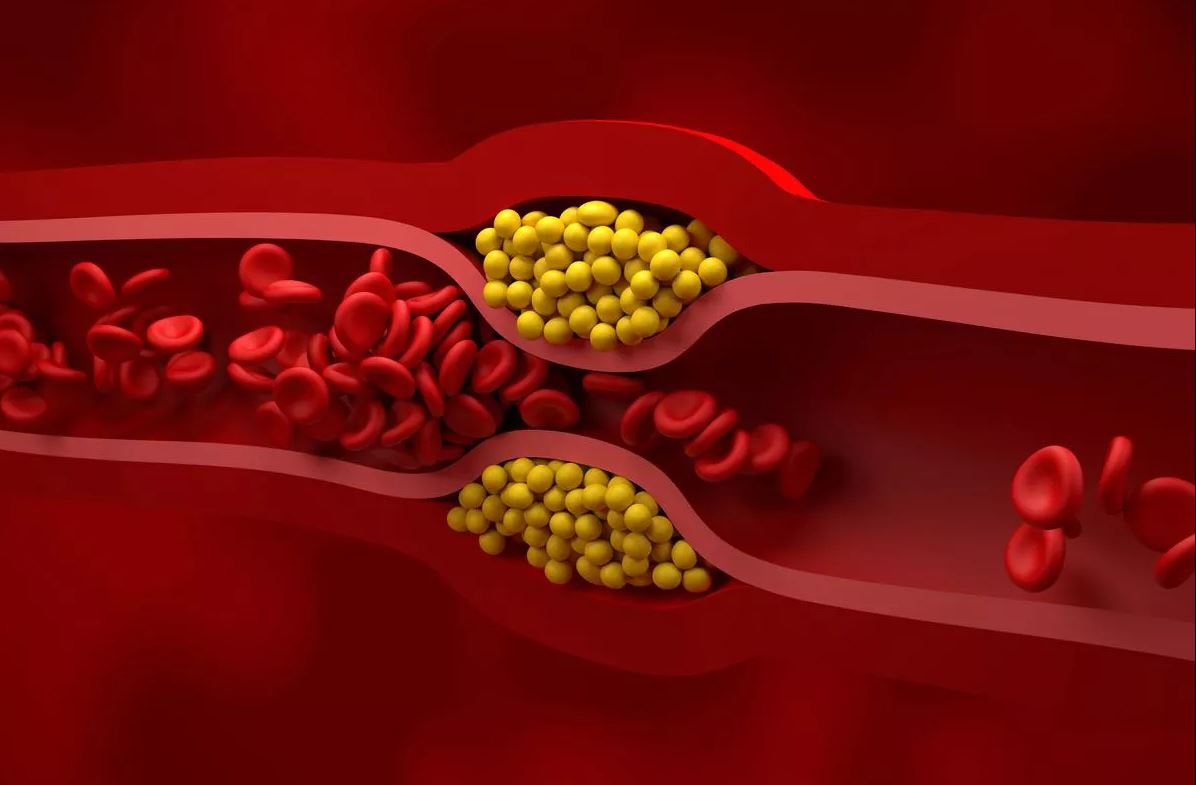 Tiết lộ siêu thực phẩm cực tốt cho cholesterol, đường huyết nhưng không phải ai cũng biết để dùng- Ảnh 2.