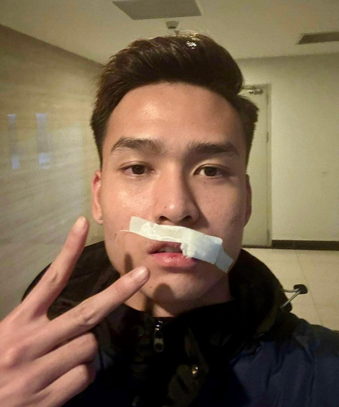 Hotboy đội tuyển Việt Nam phải khâu 24 mũi vì chấn thương, bố mẹ nghe tin khóc nghẹn vì thương con- Ảnh 1.