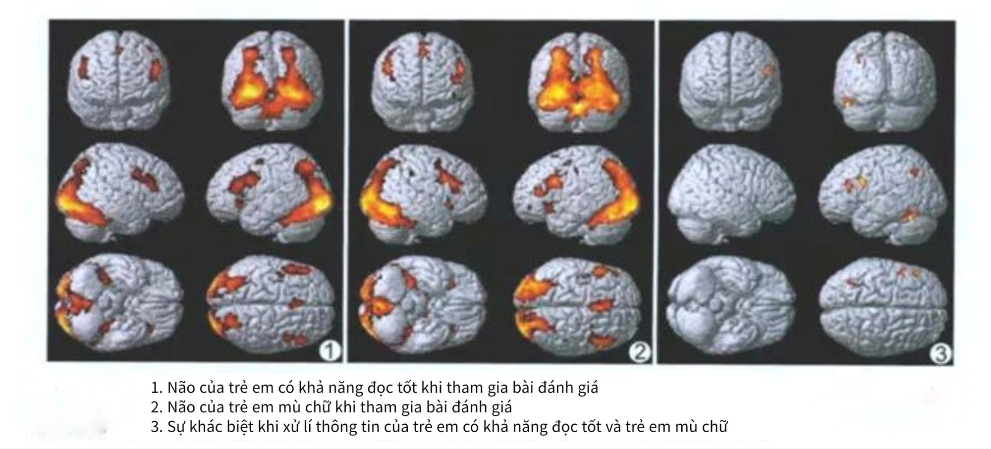 Bộ não của trẻ chăm chỉ đọc với không đọc có sự khác biệt cực lớn: Không lưu ý, 10 năm sau cha mẹ mới ngỡ ngàng- Ảnh 1.