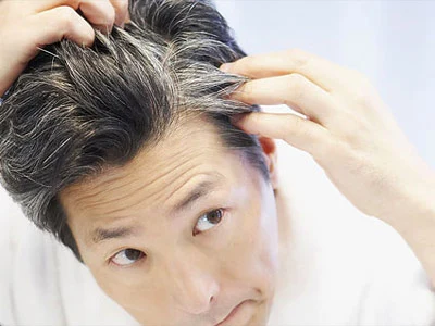 Mối quan hệ bất ngờ giữa tóc bạc và bệnh ung thư: Nghiên cứu của ĐH Harvard làm rõ thực hư- Ảnh 2.