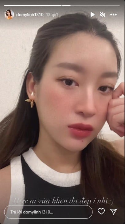 Hoa hậu Đỗ Mỹ Linh công khai tiêm thẩm mỹ, khoe cận gương mặt gây chú ý- Ảnh 3.