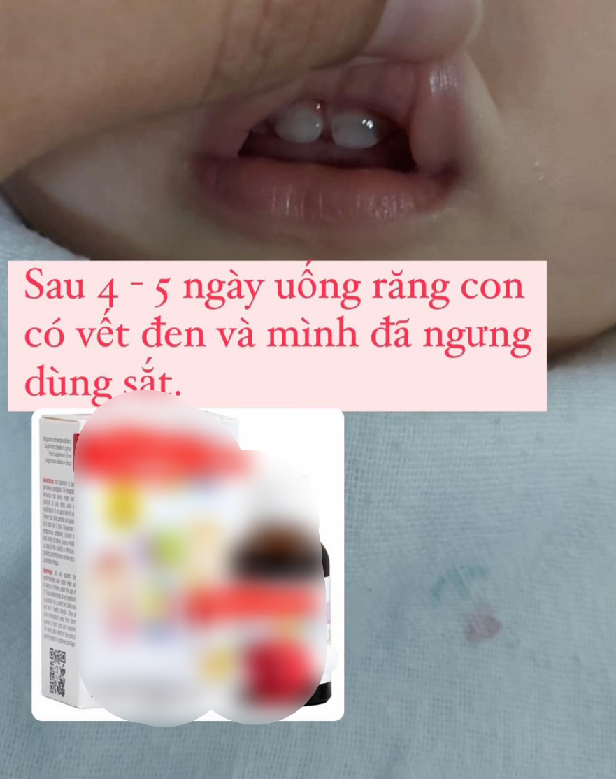 Nghe bác sĩ TikTok cho uống thứ này nghi gây hại răng của con, mẹ bỉm chất vấn 