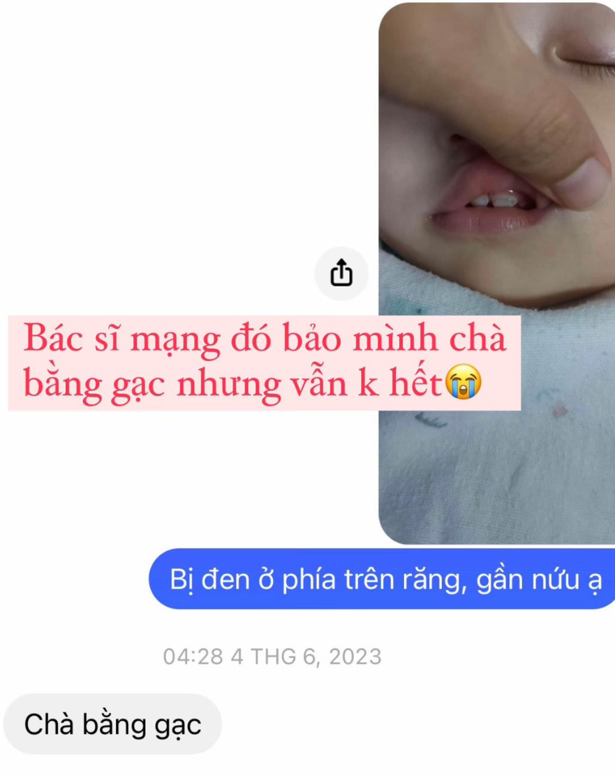 Nghe bác sĩ TikTok cho uống thứ này nghi gây hại răng của con, mẹ bỉm chất vấn 