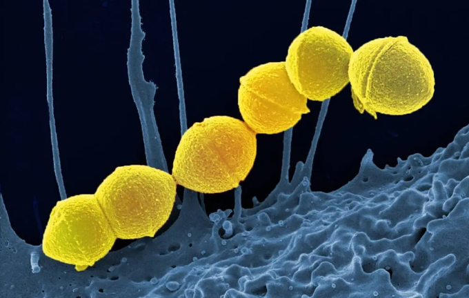 Giới y học lo ngại về vi khuẩn ăn thịt người tại Nhật Bản: 