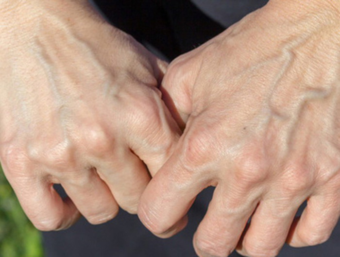 Nếu trên tay không có 5 đặc điểm này chứng tỏ bạn may mắn sở hữu lá gan khỏe mạnh- Ảnh 3.