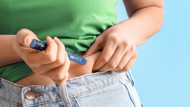 1/8 người Mỹ dùng thuốc giảm cân, mua ít hơn 8% thực phẩm so với thông thường: Khi người tiêu dùng bị lừa giữa dinh dưỡng và y tế- Ảnh 3.