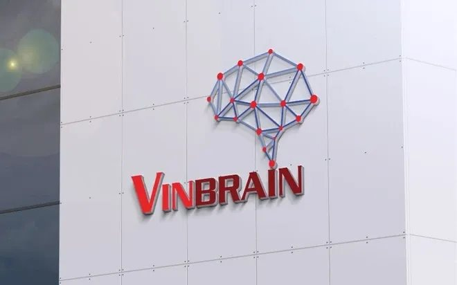 vinbrain-1736296536938-17362965370301861413701.png