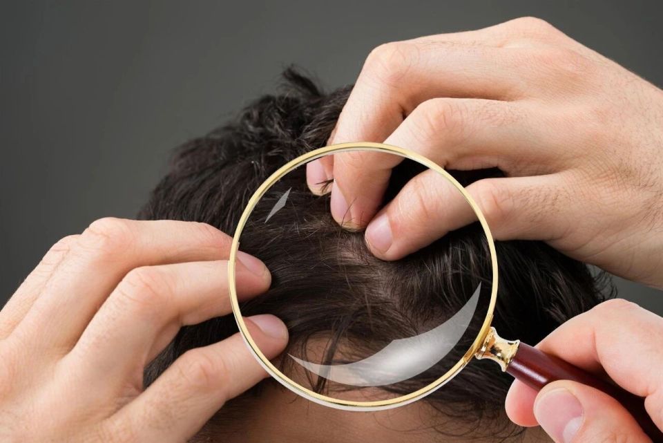 Không phải cứ có tóc bạc là lão hóa: Có 2 loại tóc trắng này trên đầu thì bạn cần đi khám sớm xem có mắc bệnh nào không- Ảnh 1. Không phải cứ có tóc bạc là lão hóa: Có 2 loại tóc trắng này trên đầu thì bạn cần đi khám sớm xem có mắc bệnh nào không- Ảnh 1.