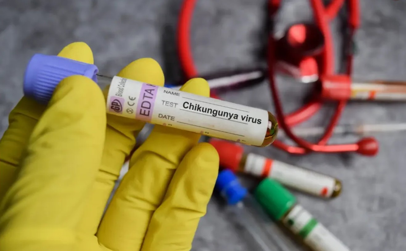 Loại virus khiến Trung Quốc phải kích hoạt kiểm soát dịch như thời Covid-19 đã xuất hiện ở quốc gia khác- Ảnh 2. Loại virus khiến Trung Quốc phải kích hoạt kiểm soát dịch như thời Covid-19 đã xuất hiện ở quốc gia khác- Ảnh 2.