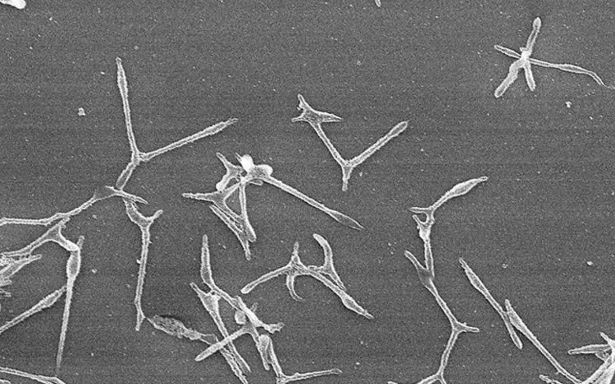 Vi khuẩn Mycoplasma pneumoniae gây ra các bệnh nhiễm trùng đường hô hấp, đặc biệt là ở trẻ em (Ảnh: Viện An ninh Y tế Nhật Bản) Vi khuẩn Mycoplasma pneumoniae gây ra các bệnh nhiễm trùng đường hô hấp, đặc biệt là ở trẻ em (Ảnh: Viện An ninh Y tế Nhật Bản)