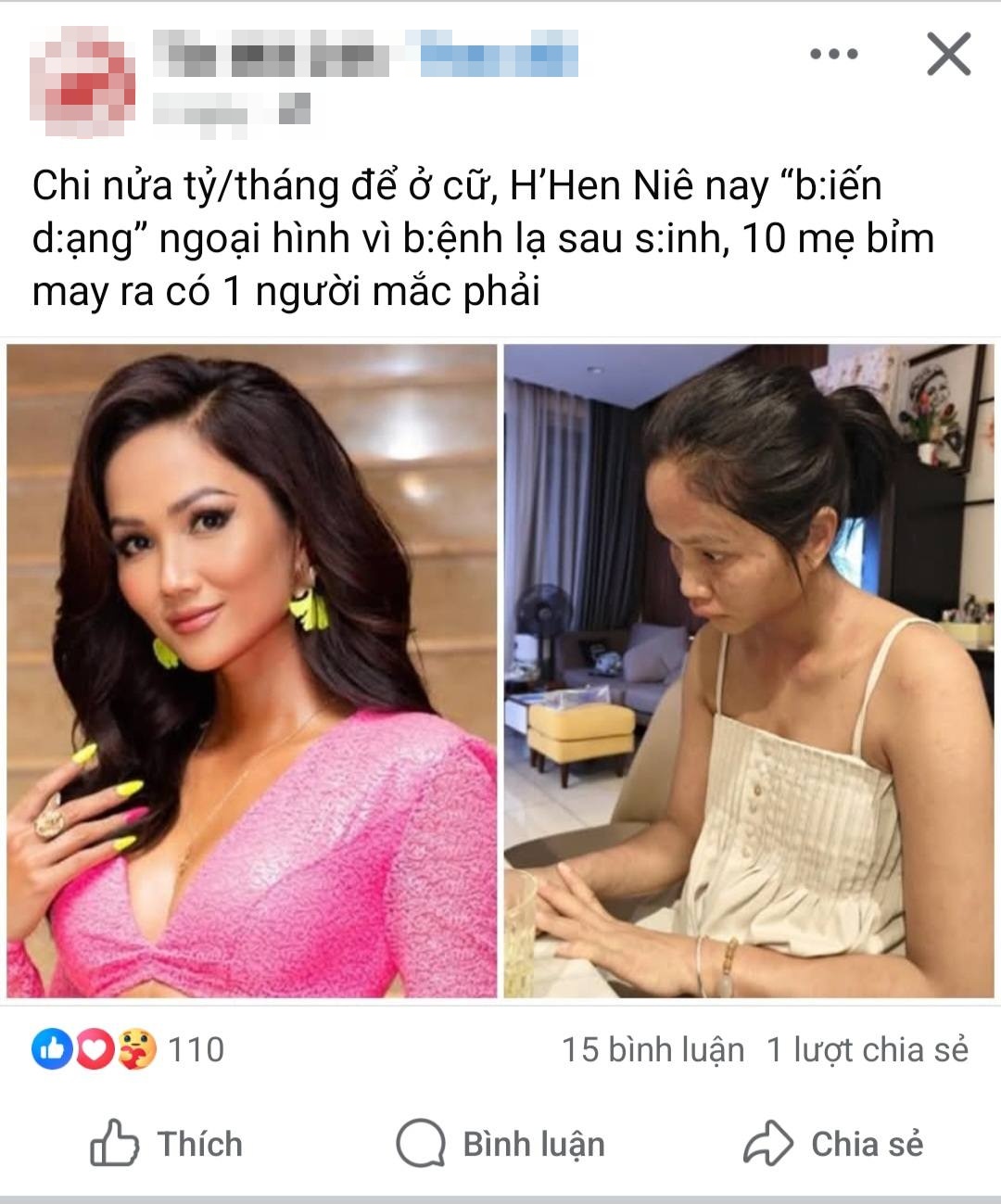 Chuyện gì xảy ra với H'Hen Niê sau khi xuất hiện với gương mặt khác lạ- Ảnh 2. Chuyện gì xảy ra với H'Hen Niê sau khi xuất hiện với gương mặt khác lạ- Ảnh 2.