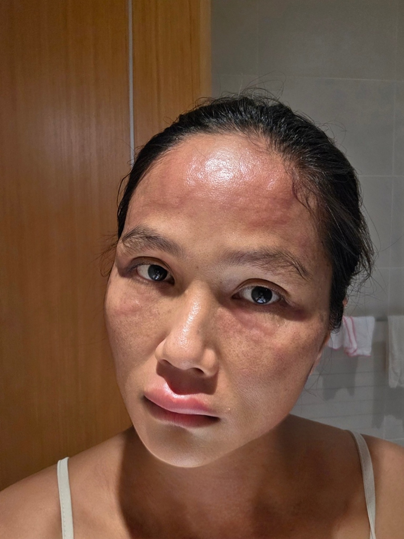 Chuyện gì xảy ra với H'Hen Niê sau khi xuất hiện với gương mặt khác lạ- Ảnh 1. Chuyện gì xảy ra với H'Hen Niê sau khi xuất hiện với gương mặt khác lạ- Ảnh 1.