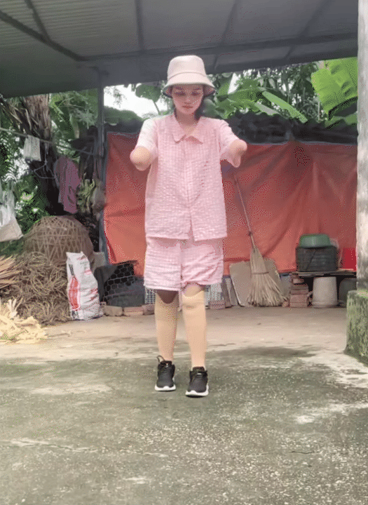 NGA TÍCH CỰC - Kênh Tiktok của mẹ 2 con mất tứ chi sau cơn bạo bệnh: Kiên cường tập luyện với đôi chân  NGA TÍCH CỰC - Kênh Tiktok của mẹ 2 con mất tứ chi sau cơn bạo bệnh: Kiên cường tập luyện với đôi chân